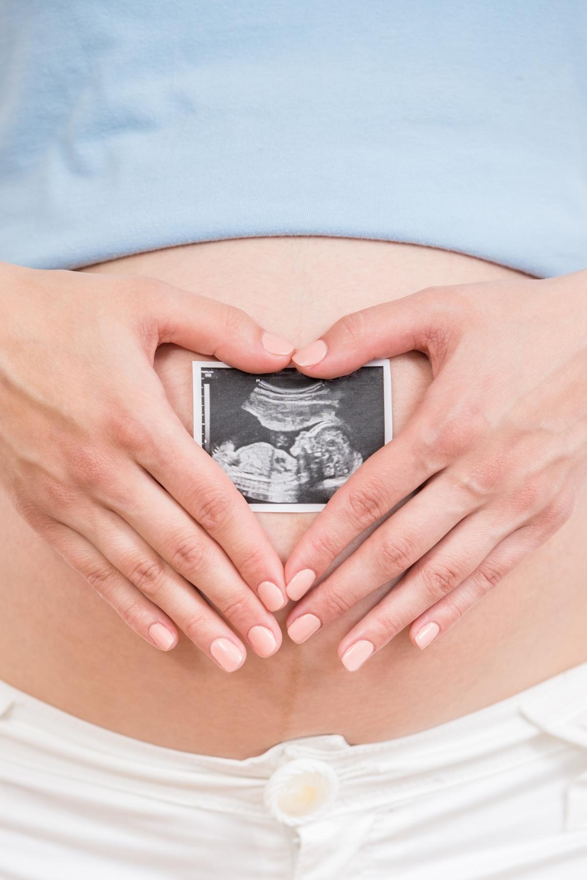 pregnant stomach with two hands in the shape of a heart holding an ultrasound image.